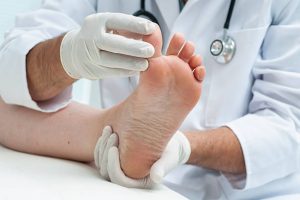 Gombás fertőzés a lábon – Tünetek és kezelés