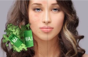 Green Acne Stick – Kozmetikai megoldás mitesszerekre! Ár és vásárlói vélemények!